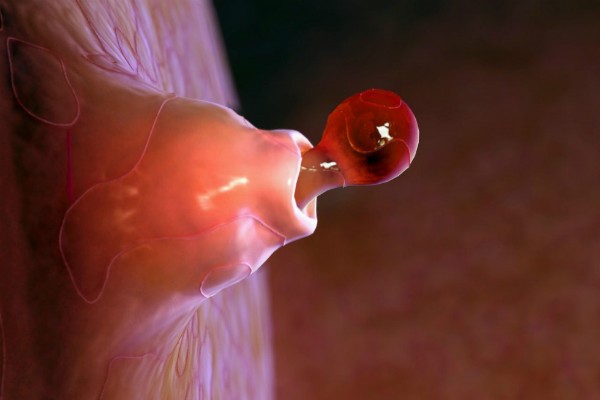 141117_2.jpg 141117_2.jpg