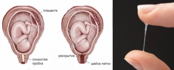 Что делать при отхождении пробки - Что делать при отхождении пробки