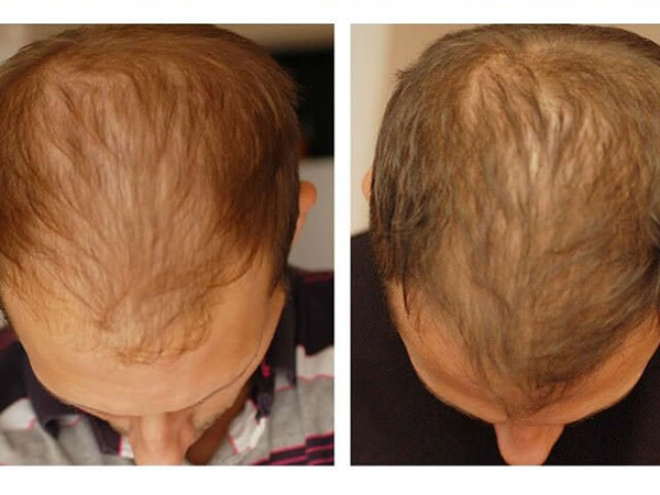 201117_2.jpg 201117_2.jpg