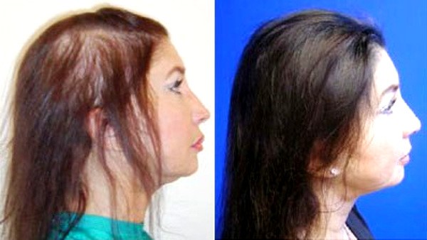 201117_57.jpg 201117_57.jpg